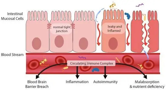 PermeabilidadIntestinal